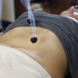 Mile High Holistic Medicine - Moxibustion