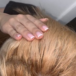 Regis Salon - Burnt scalp