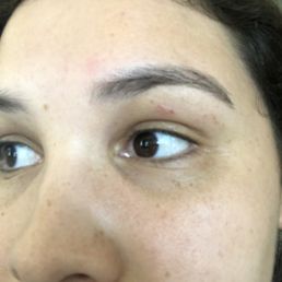 Cut during eyebrow thread