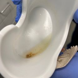 Texas Health Breeze Urgent Care - Fort Worth - The initial flush removed a large chuck of wax!