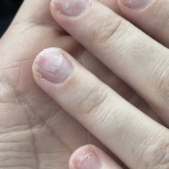 NV Nails - My scraped up, thin, horribly short nails - Nail Salons Near Me - Arden, North Carolina
