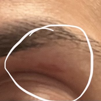 New Looks Salon - Burn under eyebrow - Nail Salons Near Me - La CaƱada Flintridge, California New Looks Salon - Burn under eyebrow - Nail Salons Near Me - La CaƱada Flintridge, California