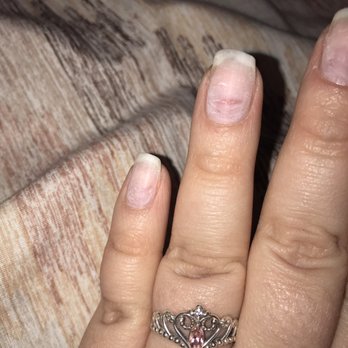 New Image Nails & Spa - Just one of my bruised, painful nail beds. - Nail Salons Near Me - Marlton, New Jersey New Image Nails & Spa - Just one of my bruised, painful nail beds. - Nail Salons Near Me - Marlton, New Jersey