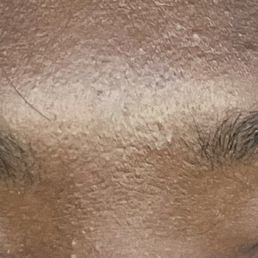 Messed up eyebrows