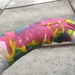 Klein David M MD - My cast