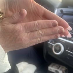 Professional Nail Salon - fungus on multiple fingers