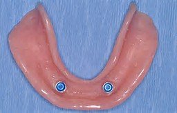 Pretty Smiles Denture Center