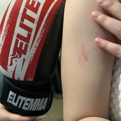 Elite MMA Baytown - A bruise from the blows that coach Britney gave my daughter