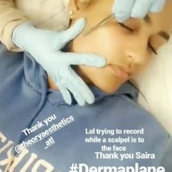 Theory Aesthetics - 02 LIFT + DERMAPLANING