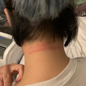 Q Cuts - Neck irritation from a razor - Hair Salons Near Me - Castro Valley, California Q Cuts - Neck irritation from a razor - Hair Salons Near Me - Castro Valley, California