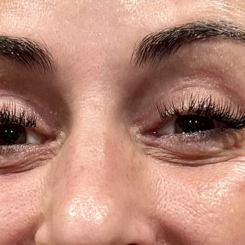 Form MD Aesthetics - Medical Spas Near Me - Mission Viejo, California