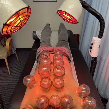 AHMC WELLNESS CENTER - Wellness - Acupuncture Near Me - Alhambra, California