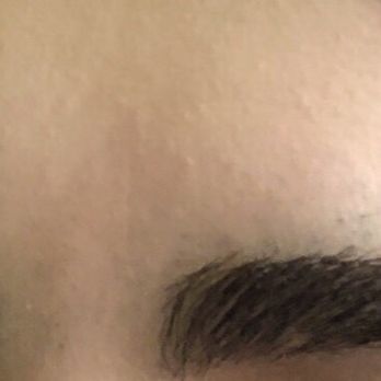 Pure Threading & Skin Care - Before! - Skin Care Near Me - Van Nuys, California