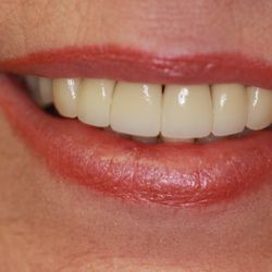 Most Dental - After