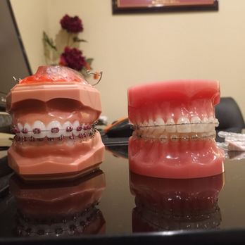 JIMMY VU NGO , DDS - Updated September 2025 - 147 Reviews