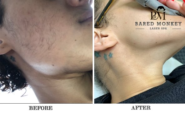 Bared Monkey Laser Spa by null