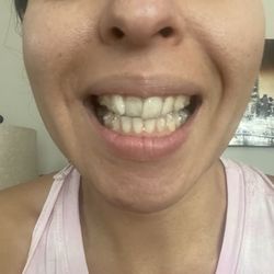 Hilda Kanon, DDS - Before treatment