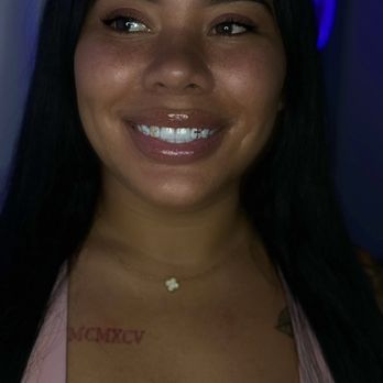 Flawless Smiles - 22K Gold Tooth Gems - Teeth Whitening Near Me - Cranston, Rhode Island