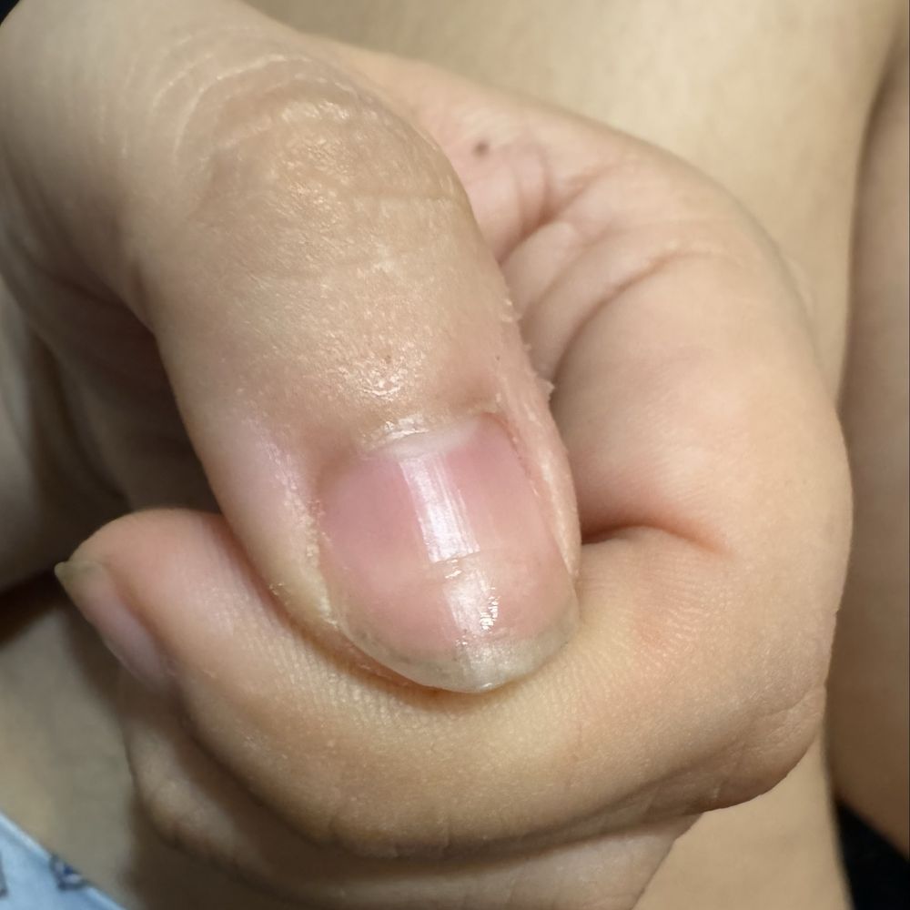 Allure Nails & Spa - Sorry my nail is a little dirty but you can see the ring clearly here - Nail Salons Near Me - Bakersfield, California Allure Nails & Spa - Sorry my nail is a little dirty but you can see the ring clearly here - Nail Salons Near Me - Bakersfield, California