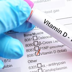 Clinica Ideal Harwin - Do you deal with Vitamin D deficiency?  We are happy to announce that with proper blood-work, we can offer you a Vitamin D course!