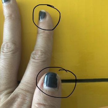 VIP Nails - Gel started peeling off after 5 day. And look at my cuticles! - Nail Salons Near Me - Charlotte, North Carolina