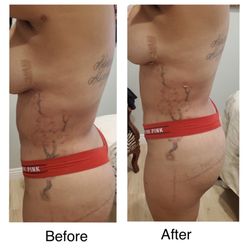 A Body By Design - Before and after.