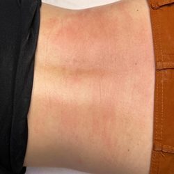 Bestetix - Lower back wax
