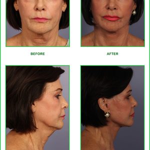 Marina Plastic Surgery on Yelp