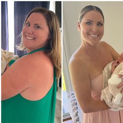 Signature Med Spa - Weight Loss Progression