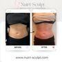 Photo of Nutrí-Sculpt