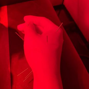 Green Acupunture - For sciatica and relaxing - Acupuncture Near Me - Oxnard, California Green Acupunture - For sciatica and relaxing - Acupuncture Near Me - Oxnard, California