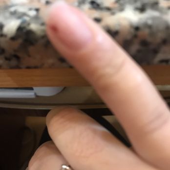 Nails New Concept - My finger bleeding underneath the nail from the dip powder being aggressively yanked off - Nail Salons Near Me - Philadelphia, Pennsylvania