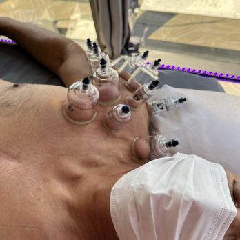 Inner Chi Hawai'i - Cupping - Acupuncture Near Me - Honolulu, Hawaii