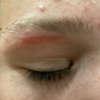 Model Nail Salon - Burn from wax - Nail Salons Near Me - Bakersfield, California