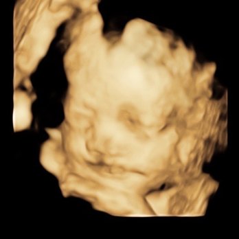 4D Miracles - Ultrasound Imaging Centers Near Me - Fremont, California 4D Miracles - Ultrasound Imaging Centers Near Me - Fremont, California