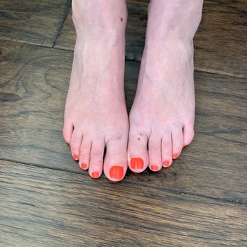 LiLy Nails & Spa - Pedicure is one week old. Blisters are my own - Nail Salons Near Me - Springfield, Virginia LiLy Nails & Spa - Pedicure is one week old. Blisters are my own - Nail Salons Near Me - Springfield, Virginia