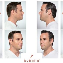 Qvita Health and Wellness - Kybella for submental and other problem area fat reduction.