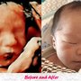 Photo of BB Precious Ultrasound