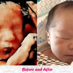 BB Precious Ultrasound - B.B. Precious - Ultrasound Imagery 3d / HD Live Ultrasound Scans www.bbprecious.com