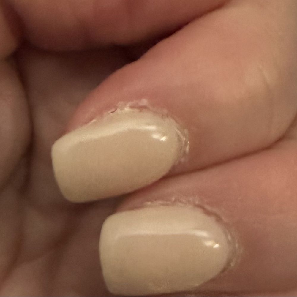 Cuticles not at all trimmed and the edges are messy Cuticles not at all trimmed and the edges are messy