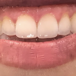 Mountain Ridge Dental - Before