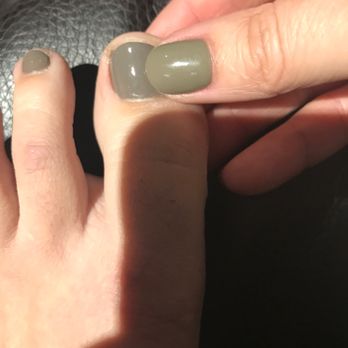 Wonder Nails - you can see they are not the same color in our opinions and the two dips in the side of my thumb nail - Nail Salons Near Me - Livonia, Michigan Wonder Nails - you can see they are not the same color in our opinions and the two dips in the side of my thumb nail - Nail Salons Near Me - Livonia, Michigan