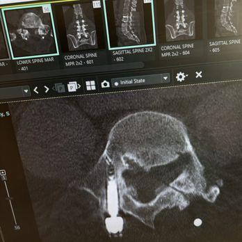 Jacksonville Brain and Spine - Spine Surgeons Near Me - Jacksonville, Florida Jacksonville Brain and Spine - Spine Surgeons Near Me - Jacksonville, Florida