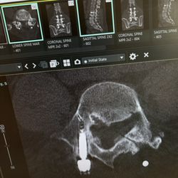 Jacksonville Brain and Spine