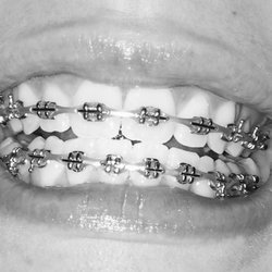 Risas Dental and Braces - Metro