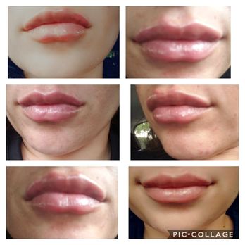 My Look - Cosmetic Surgeons Near Me - Pasadena, California