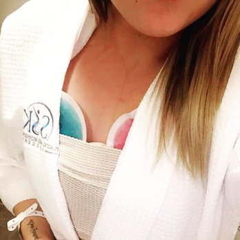 SSK Plastic Surgery - 11/15/16- bi-lateral breast augmentation with 605cc high profile silicone gel implants. I feel minimal (if any at all) pain! - Cosmetic Surgeons Near Me - Newport Beach, California