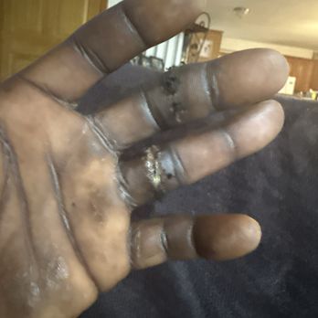 Budget Inn - My cut up two fingers that I will never be able to use for the rest of my life - Hotels Near Me - Upper Marlboro, Maryland Budget Inn - My cut up two fingers that I will never be able to use for the rest of my life - Hotels Near Me - Upper Marlboro, Maryland