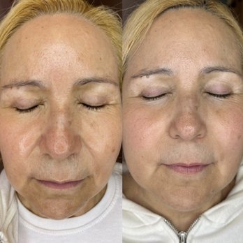 Beloved Clinical - Skin Care Near Me - Downey, California