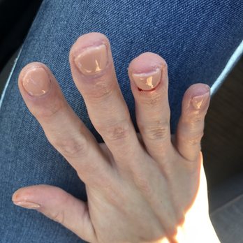 HN Passion Nails - Baked clear gel on my skin above my nails. - Nail Salons Near Me - Glendale, California HN Passion Nails - Baked clear gel on my skin above my nails. - Nail Salons Near Me - Glendale, California